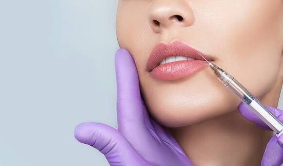 Female Models – Full-Face Transformation (Botox + Filler)